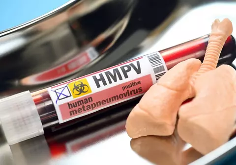 Tot ce trebuie să știm despre virusul HMPV. Epidemiologii români: „Puțin probabil să apară o pandemie”