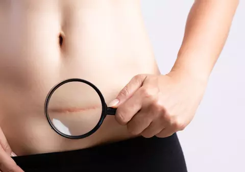 Turcia a interzis nașterea prin cezariană în centrele medicale private: „Doar nașterea normală e naturală”