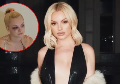 Crima din Cosmopolis a redeschis răni vechi pentru Alexandra Stan. Artista a fost victima violenței în trecut: „Agresiunea nu e doar cea fizică, ci și psihică și emoţională”