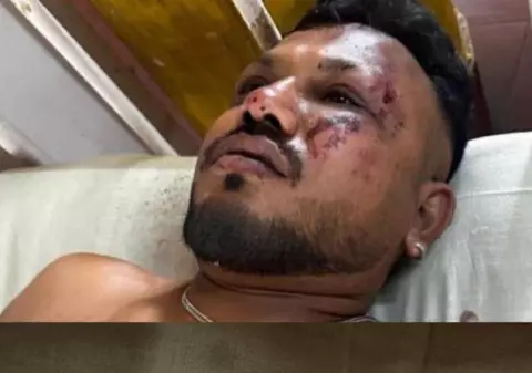 Un bărbat a supraviețuit miraculos prăbușirii avionului în India. Mărturiile cetățeanului britanic despre momentul impactului