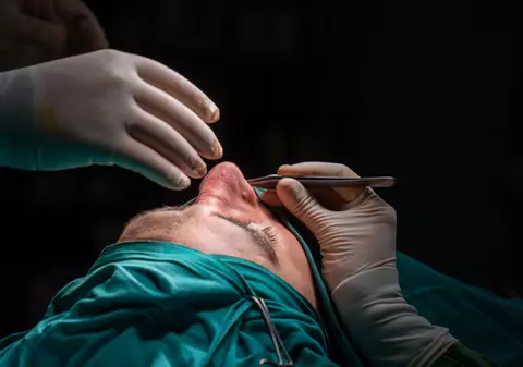 Rinoplastie estetică sau septoplastie? Diferențe și recomandări