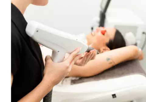 Îndepărtarea tatuajelor: de ce contează calitatea aparatului folosit?