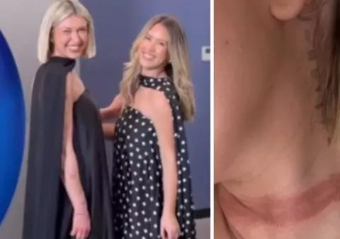 O influenceriță a fost „aproape decapitată” după ce eșarfa de mătase i s-a prins în mașină