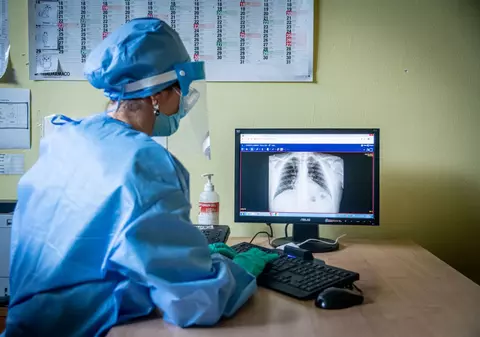 Medicii au fost șocați când au văzut radiografia unui bărbat care a mers la spital cu dureri în piept. Ce au descoperit
