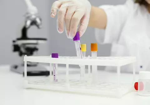 Laboratorul inteligent: de la analize clasice la prevenție asistată de AI