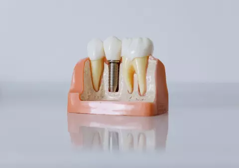 Angelescu Dental Clinic - locul unde estetica dentară întâlnește sănătatea