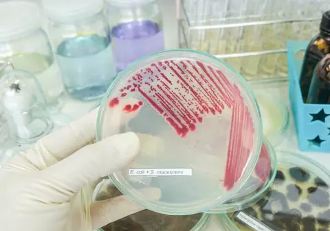 (P) Infecțiile spitalicești nu trebuie să mai ucidă: apel pentru implementarea tehnologiilor moderne în România
