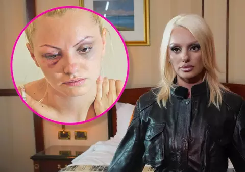 Alexandra Stan, declarații cutremurătoare la 12 ani după ce a fost bătută de fostul manager: „Aveam un profil de victimă, victima caută agresor”