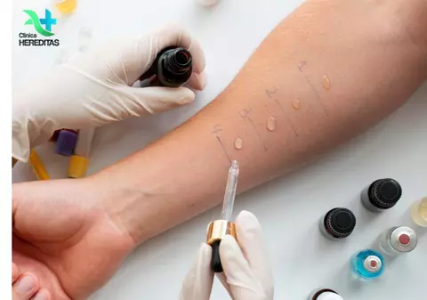 Cum recunoști alergiile și când să faci un test alergologic în Suceava, la clinica Hereditas