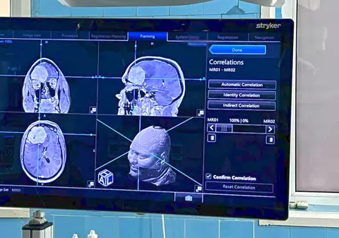 Operație pe creier la Galați, în premieră, realizată cu ajutorul Sistemului de Neuronavigație: Funcționează ca un GPS