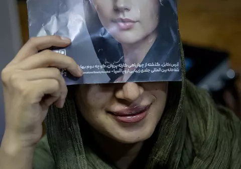 Chirurgia estetică înflorește în secret în Afganistan, sub nasul talibanilor: „Botox pe sub burka. Să fim frumoase în oglindă ne dă energie!”