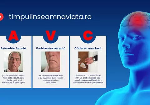 Accidentul vascular cerebral, o urgență medicală majoră