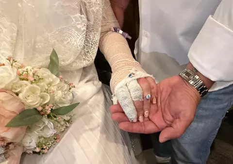 Un spital din Florida a organizat nunta unei paciente cu arsuri grave suferite într-un accident la grătar