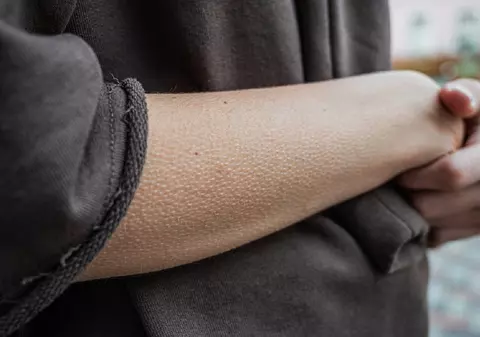 De ce se face pielea de găină şi cum apare această reacţie