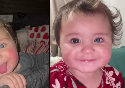 Un bebeluș s-a născut cu două culori diferite ale pielii, părului și ochilor uimind medicii