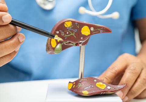 Avertismentul medicilor: Ficatul gras îmbolnăvește inima. Campania care explică de ce steatoza nu este un diagnostic banal