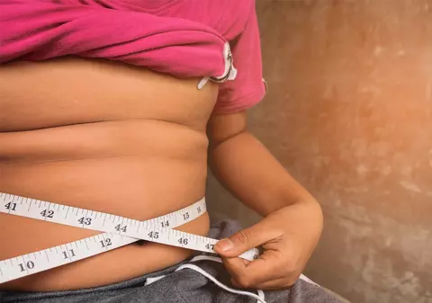 „7 din 10 bărbați și 6 din 10 femei se luptă cu obezitatea. Autoritățile pregătesc un program național de tratament”