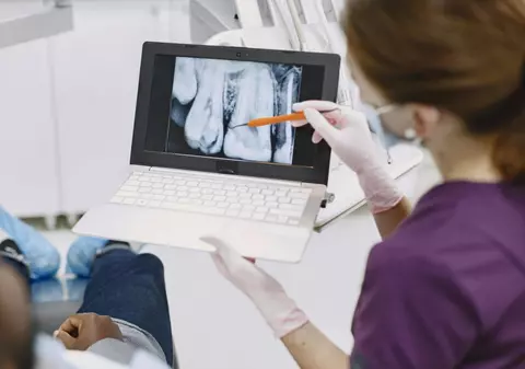 Implant dentar în 2026: ce influențează costul și ce ar trebui să știi înainte de tratament