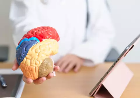 Timpul de reacție în cazul unui accident vascular cerebral e esențial: ,,Ne limităm la 4,5 ore maxim de la debut pentru tromboliză”