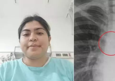 Cum s-a trezit o femeie cu un piercing în plămâni: „Nu mi-aș mai pune unul”