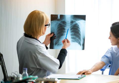 De ce crește alarmant în România numărul cazurilor de cancer pulmonar la nefumători și cum ucide poluarea ascunsă din orașe