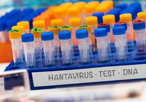 Dr. Adrian Marinescu, despre cazul de hantavirus din România: „E o isterie! Virusul e banal, nu are nicio legătură cu ce s-a întâmplat pe vapor și nu este de import”