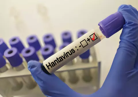 Țara în care numărul cazurilor de hantavirus este în creștere. Experții dau vina și pe schimbările climatice