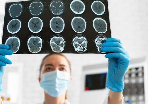 Peste 60.000 de români suferă anual traumatisme craniene grave! Accidentele rutiere fac prăpăd: costul tratamentului pentru un singur pacient poate ajunge la 4 milioane de dolari