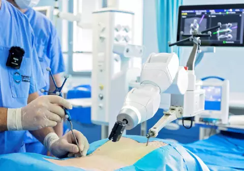 Tehnologia care îndreaptă vieți, dar costă o avere. Poveștile tinerilor care au învins scolioza datorită chirurgiei robotice și realitatea dură din spitalele din România