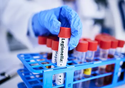 Unde se ascunde bacteria mortală Legionella, care prosperă pe caniculă. Află cum te poți infecta fără să știi