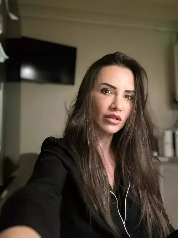 Cum Arată Mara Bănică După Operația Estetică La Față, Care A Costat 15.000  De Euro. Fanii Au Criticat-o: „Nu Mai Ești Tu, Nu îți Stă Bine” | Libertatea