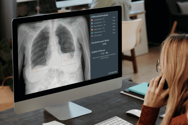 Medicii MedLife atrag atenția asupra importanței investigațiilor imagistice în diagnosticarea cancerului pulmonar și explică rolul inteligenței artificiale în acest proces