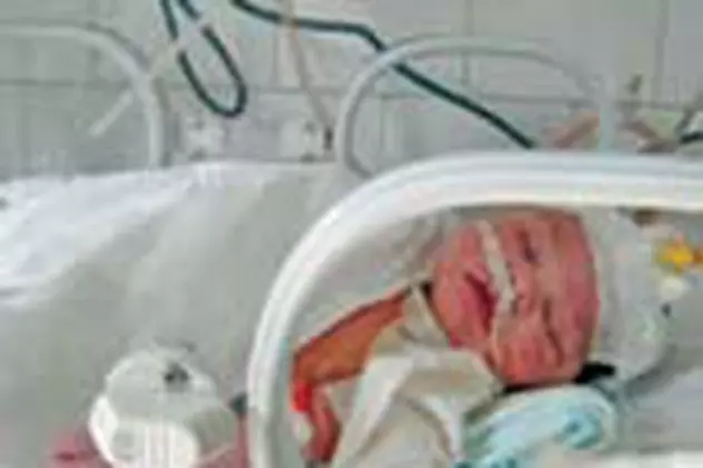 Bebelus chinuit cu doua operatii