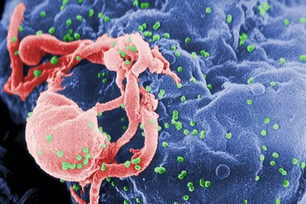 Anticorpi care ucid 99% dintre tulpinile de HIV