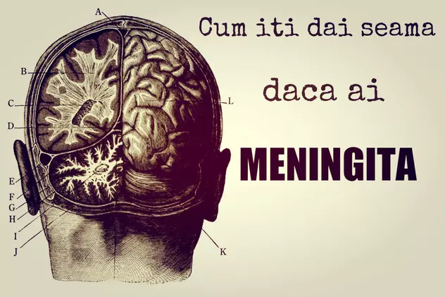 CUM ÎȚI DAI SEAMA CĂ AI MENINGITĂ