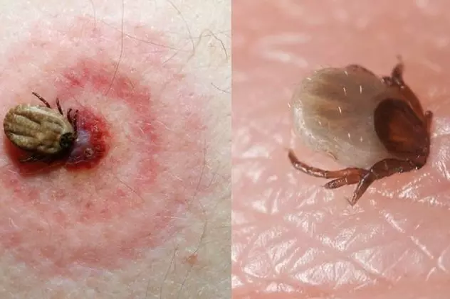 Boala Lyme: riscul de infectare este mic!