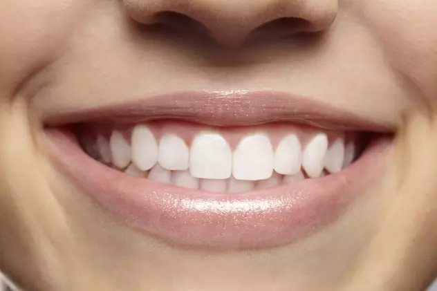 6 metode naturale de albire a dinţilor