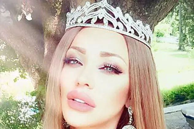 Bianca Drăgușanu, exasperată de buzele prea mari! "Nu știu cum să scap de ele"