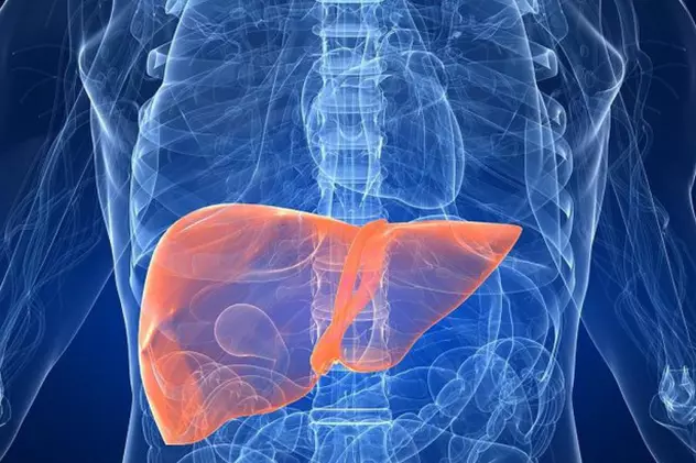 Ciroza hepatică este una dintre cele mai grave boli ale ficatului