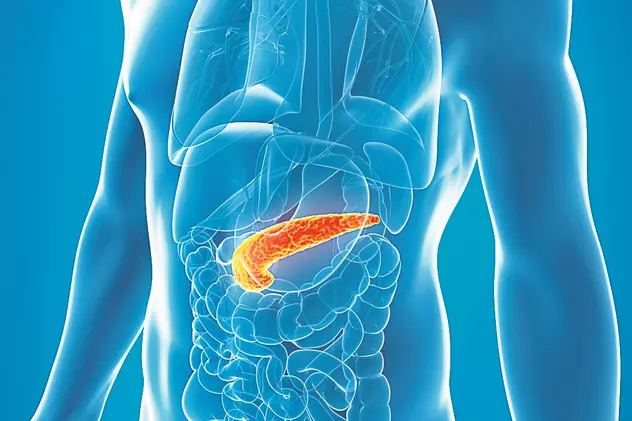 Cancerul pancreatic e... compus din patru cancere diferite!