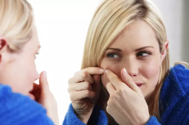 11 metode de a-ți ascunde coșurile de pe față fără a le acoperi cu machiaj