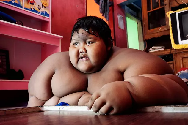 Uluitor: Un copil de 10 ani cântărește 192 de kilograme