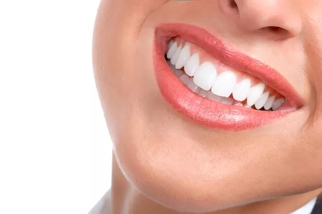 Mituri despre îngrijirea dentară în care nu trebuie să mai crezi