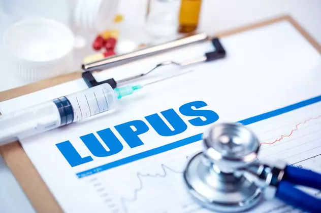 Diagnosticul de Lupus poate fi stabilita numai de către medic