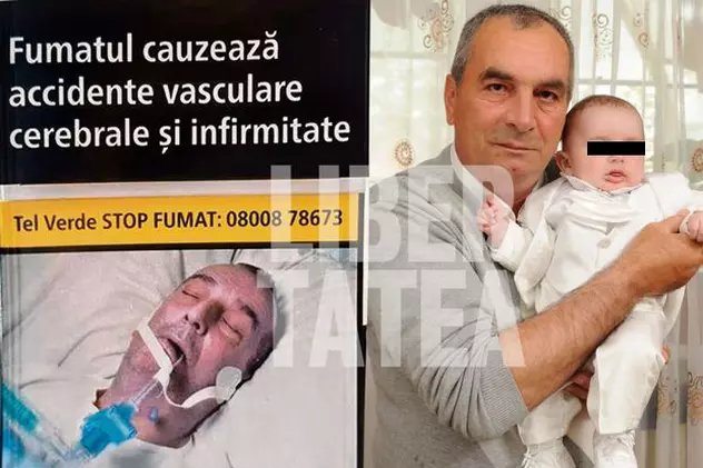 UPDATE: Primele fotografii cu românul a cărui poză ar fi fost folosită abuziv pe pachetele de țigări. ”Persoana nu a fost operată la Institutul Inimii din Cluj”
