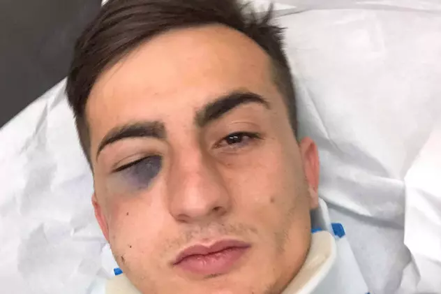 Cum se simte Denis Brînzan, căpitanul de la Pandurii, după accidentarea gravă de la Timișoara: ”Trebuie să facă trei operații”
