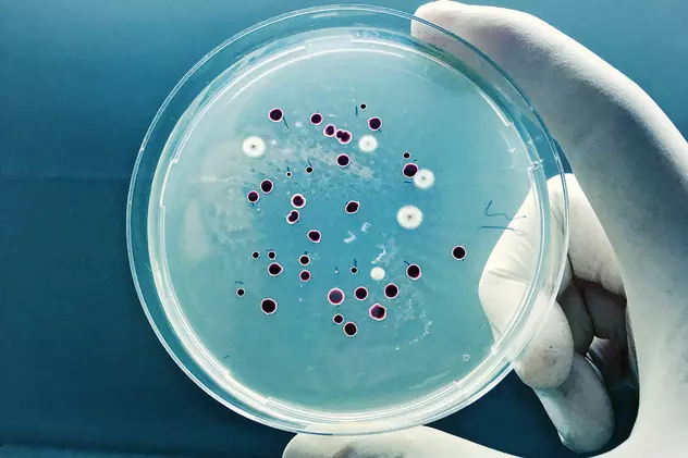 ASSMB a limitat experimentul cu coloniile de bacterii în condiții de biosecuritate de la 4.000 de clase la doar trei școli cu un total de 100 de clase