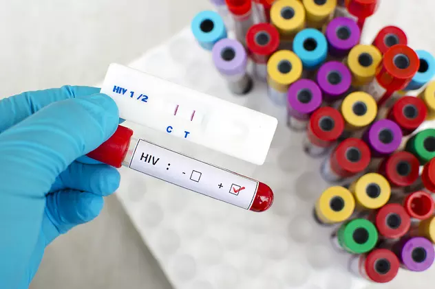 Un caz rar: al doilea pacient cu HIV care s-ar fi „vindecat” fără tratament cu celule stem