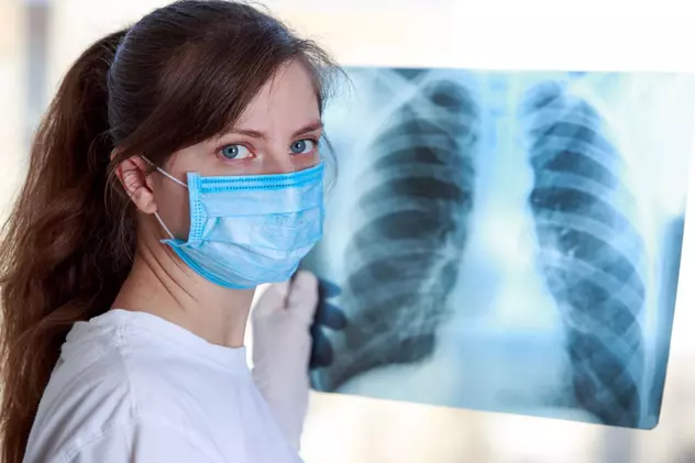 Avertisment al experților chinezi: pacienții asimptomatici COVID-19 pot dezvolta leziuni pulmonare