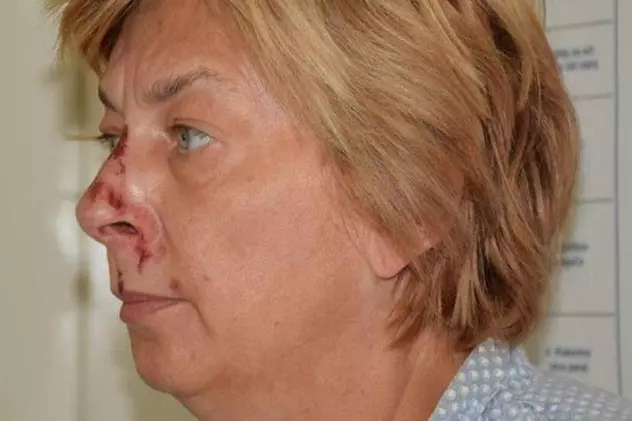 O femeie găsită într-o zonă pustie din Croația nu își amintește cum a ajuns acolo. Ce au descoperit acum autoritățile
